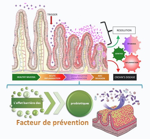 déséquilibre intestinale